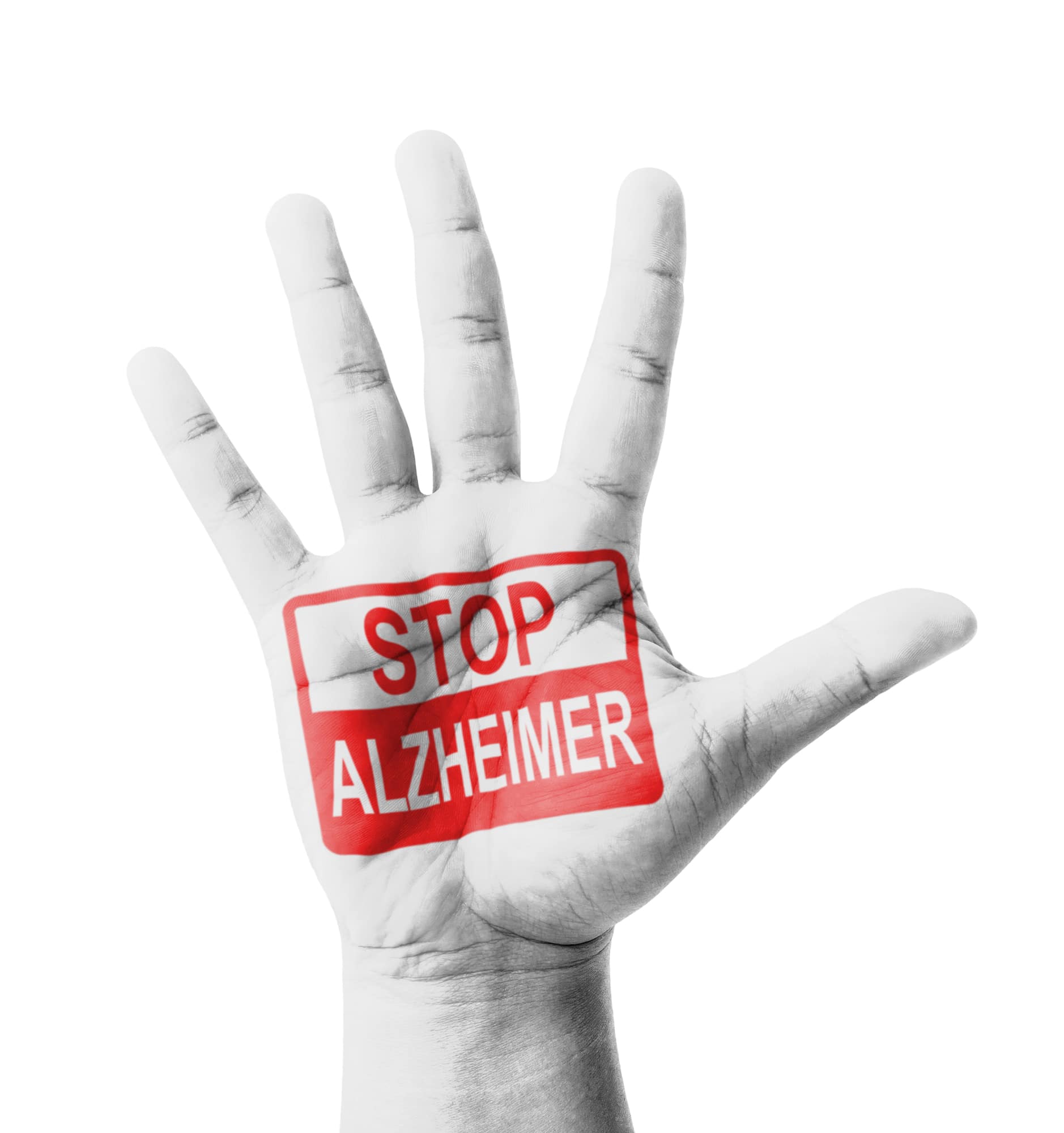 the end of Alzheimer's