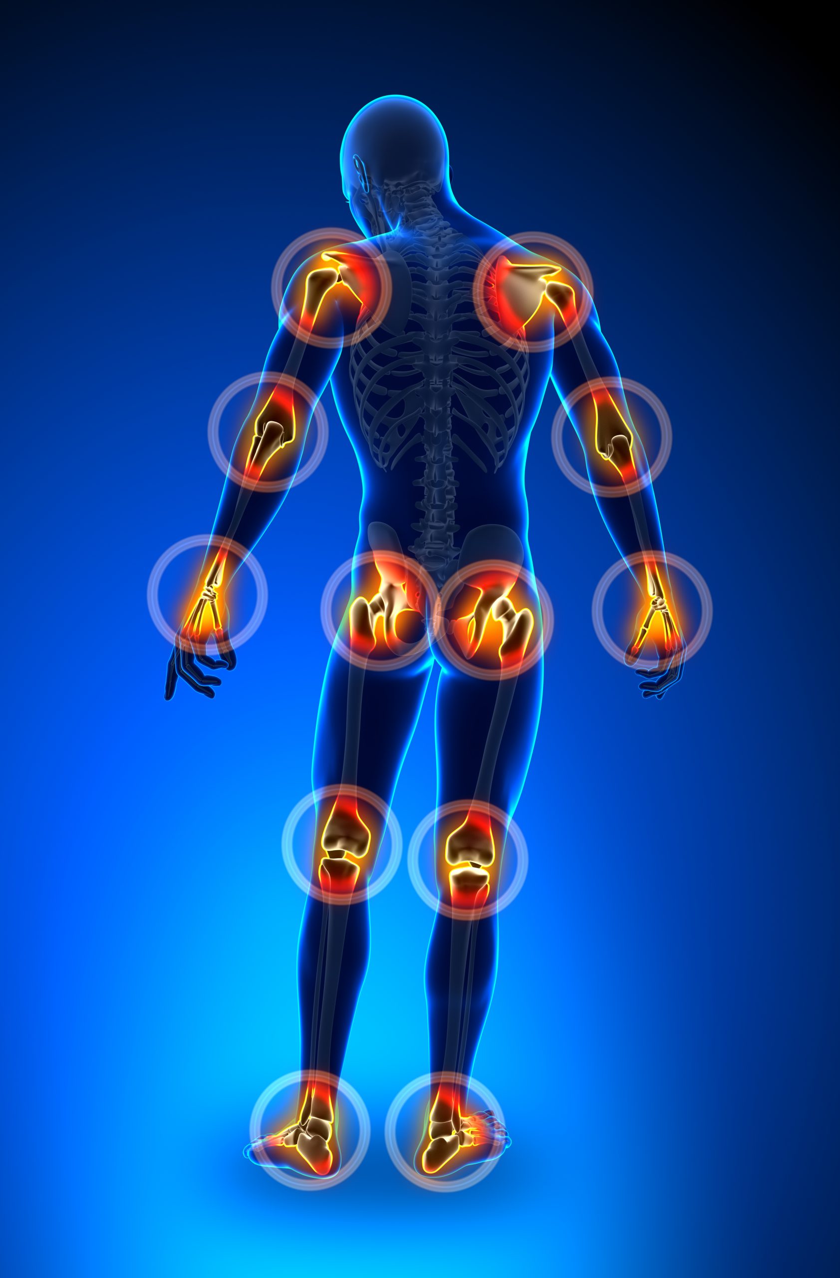 inflammation, foods that cause inflammation, bladder inflammation, heart inflammation, what is inflammation, how to reduce inflammation in the body fast, inflammation diet